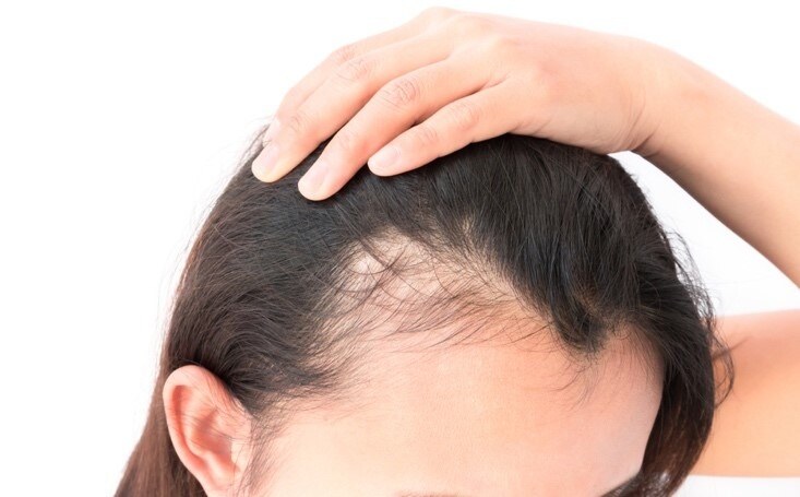 menopause-hair-loss-medication